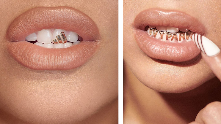 Beyoncé and Grillz: The Beginning of a Dental Revolution in the Fashion World