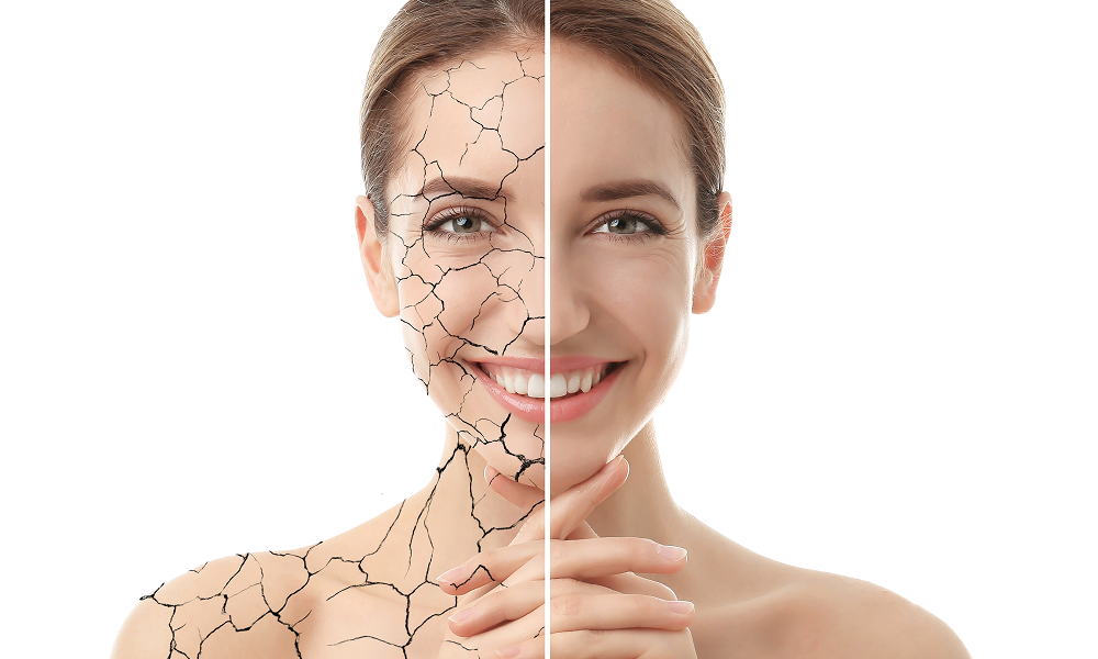 Dehydrated or Dry Skin? Learn the Differences and Key Signs