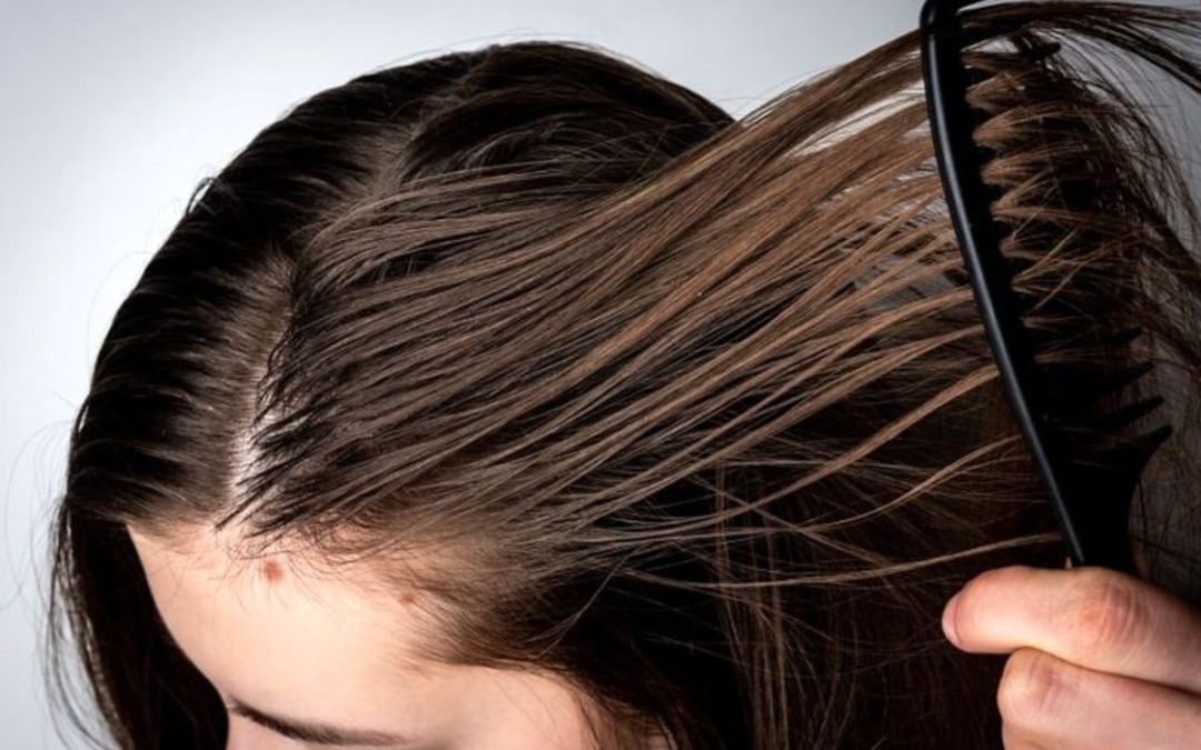 Why Do Our Hair Become Oily?